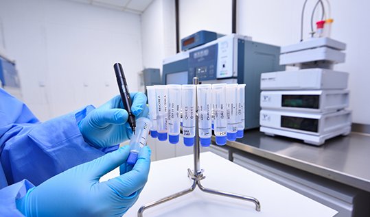 Медицинская сестра маркирует пробирки с биоматериалом в лаборатории